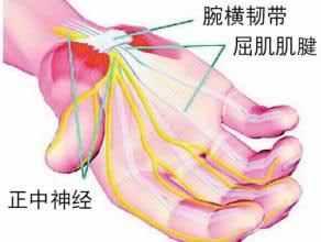 無法治愈的職業病？哭，我也在裏面……告訴你鼠标手有(yǒu)多(duō)恐怖！